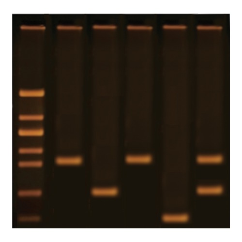 DNA 지문분석